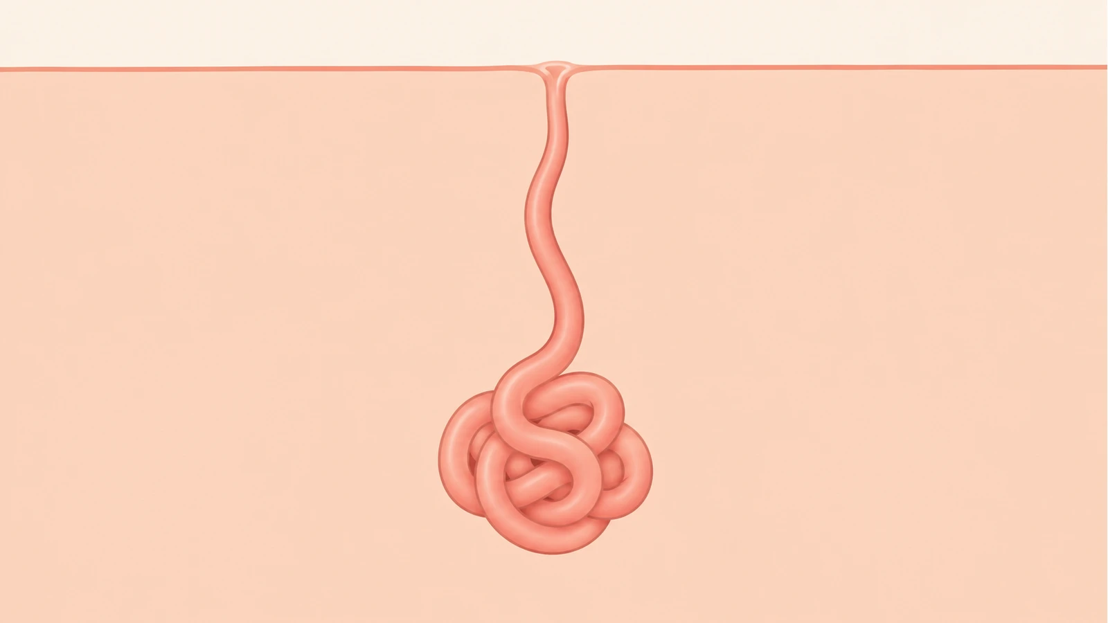 피부 표면으로 직접 이어지는 한 개의 관과 아래쪽에 굽이친 에크린 땀샘을 나타낸 구조 그림